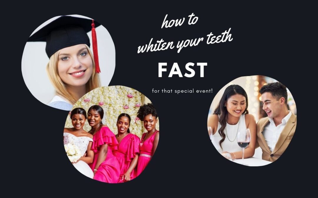 How to Whiten Teeth FAST (in 2022)